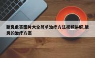 腋臭危害图片大全简单治疗方法视频讲解,腋臭的治疗方案