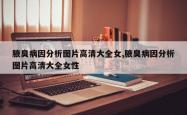 腋臭病因分析图片高清大全女,腋臭病因分析图片高清大全女性