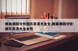 腋臭病因分析图片高清大全女,腋臭病因分析图片高清大全女性