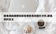 腋臭病因病理机制有哪些表现图片分析,腋臭症的定义