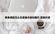 腋臭病因怎么检查确诊指标图片,腋臭科普