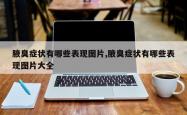 腋臭症状有哪些表现图片,腋臭症状有哪些表现图片大全