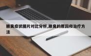 腋臭症状图片对比分析,腋臭的原因和治疗方法
