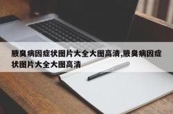 腋臭病因症状图片大全大图高清,腋臭病因症状图片大全大图高清